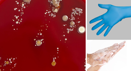 Plastic Occlusion and Staphylococcus aureus